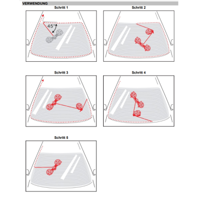 Priekinio stiklo montavimo rinkinys (69506) 3 Priekinio stiklo montavimo rinkinys (69506) 3